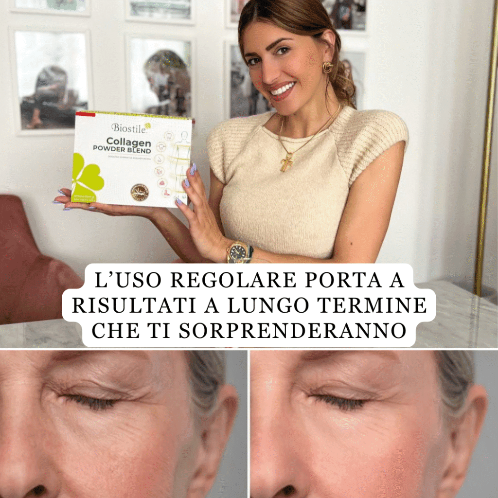 brand collagen s hialuronsko kislino darilo shaker mladosten videz lp 1