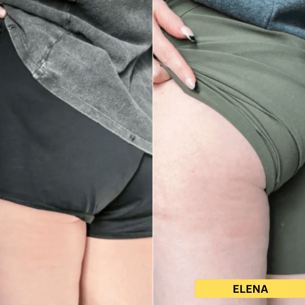 elp celuline 21 gratis